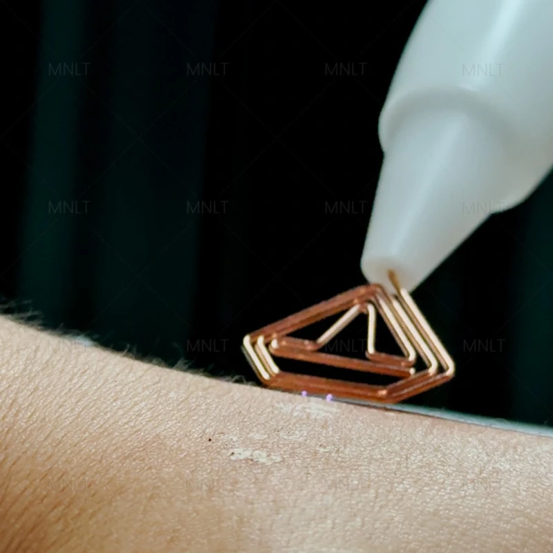 Hot & Cold Plasma Machine – Next-Gen Skin Rejuvenation Technology high quality