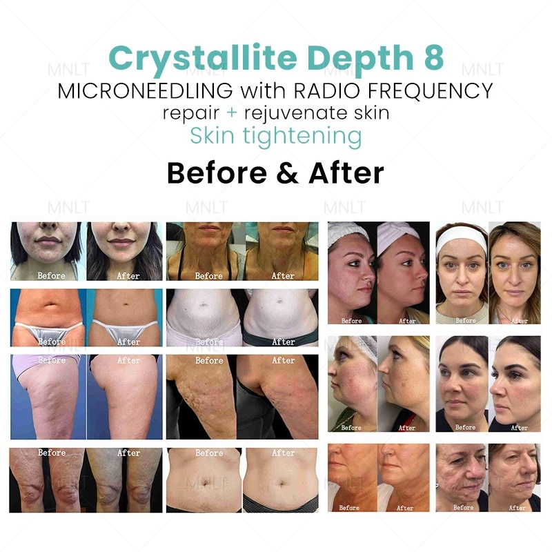 Portable Crystallite Depth 8 Morphues 8 Machine